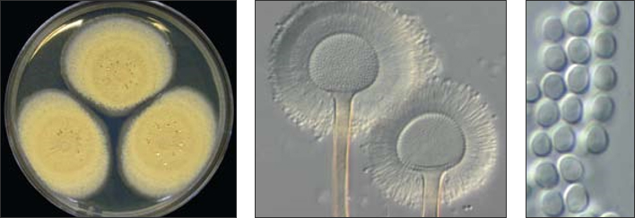  Aspergillus ochraceus, ba tản nấm trên môi trường Czapek yeast autolysate agar (trái), bào tử vô tính mọc đầy trên đầu cành bào tử phân sinh (giữa), bào tử vô tính (phải)