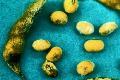 Hạt đâu - Bệnh mốc vàng hạt đậu tương (Aspergillus spp) 